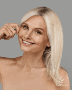 Biostimulation mit Sculptra und Radiesse Stuttgart