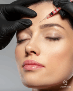 Botulinum Toxin Stuttgart