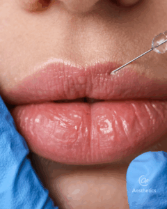 Natürlich schöne Lippen Stuttgart