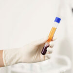 PRP (Platelet Rich Plasma) und Mesotherapie
