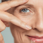 Augenringe Behandeln