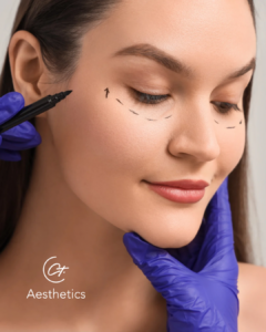 Unterlidstraffung ohne OP