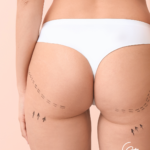 Sculptra Body